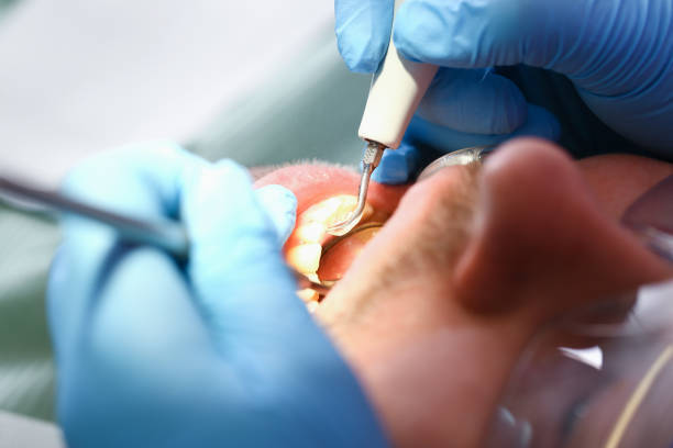 Best Dentist for Tooth Abscess  in Brownlee Park, MI